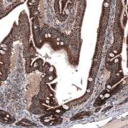 ZDHHC14 Antibody, Novus Biologicals 0.1mL; Unlabeled:Antibodies, Polyclonal